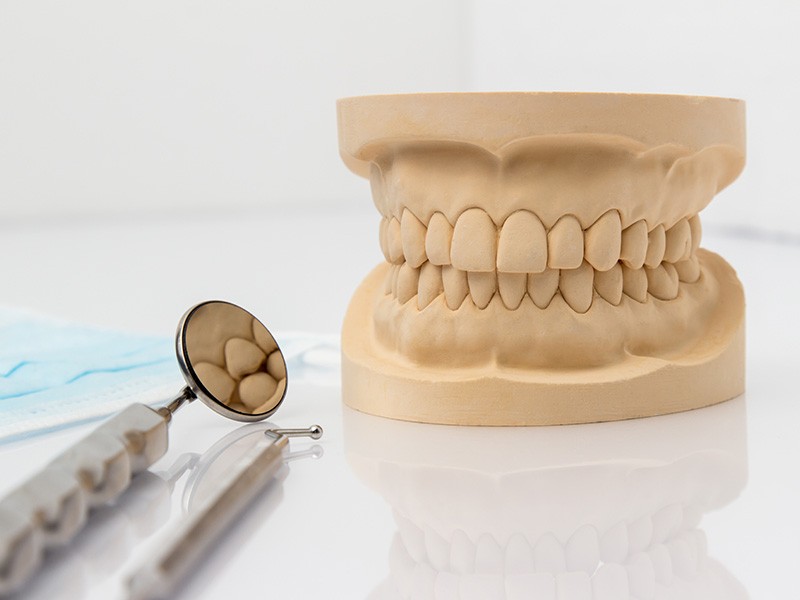 全瓷牙冠 全瓷牙冠